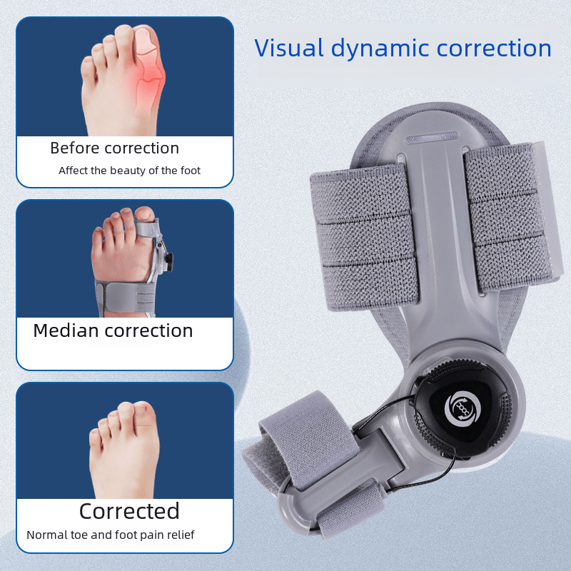 Upgraded Adjustable Bunion Corrector - Serene